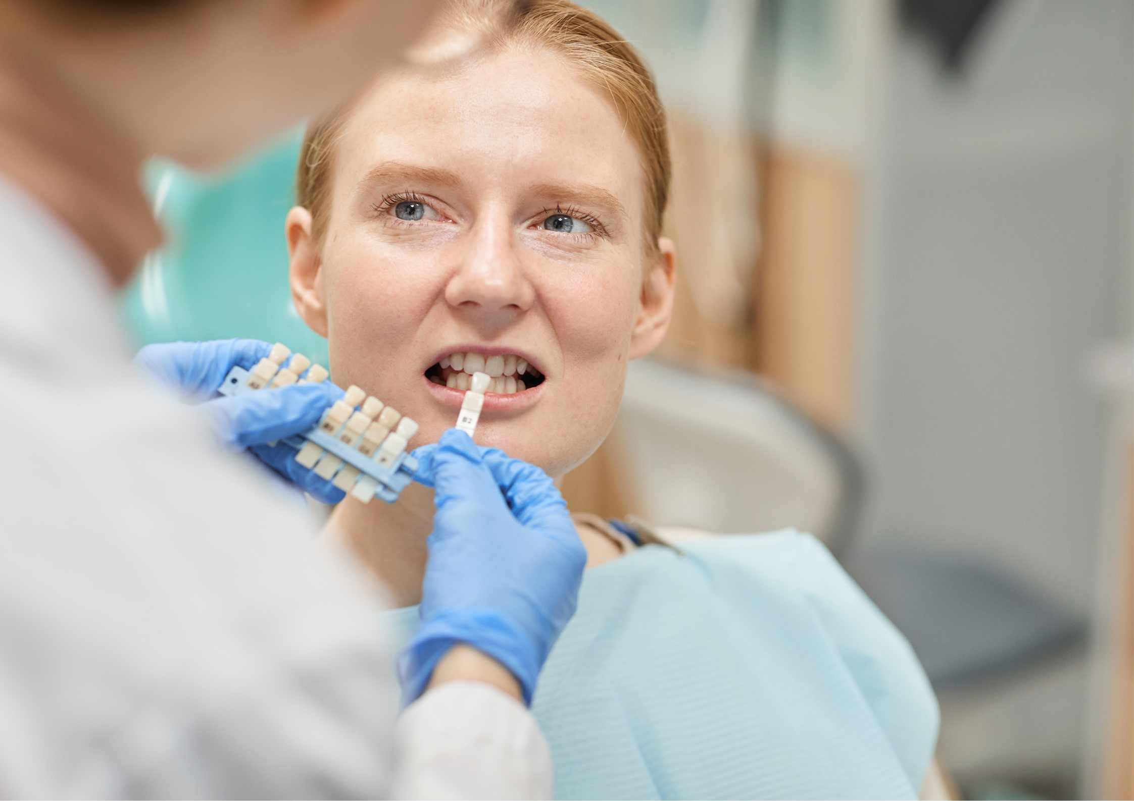 What Are Capped Teeth And How To Care For Them?