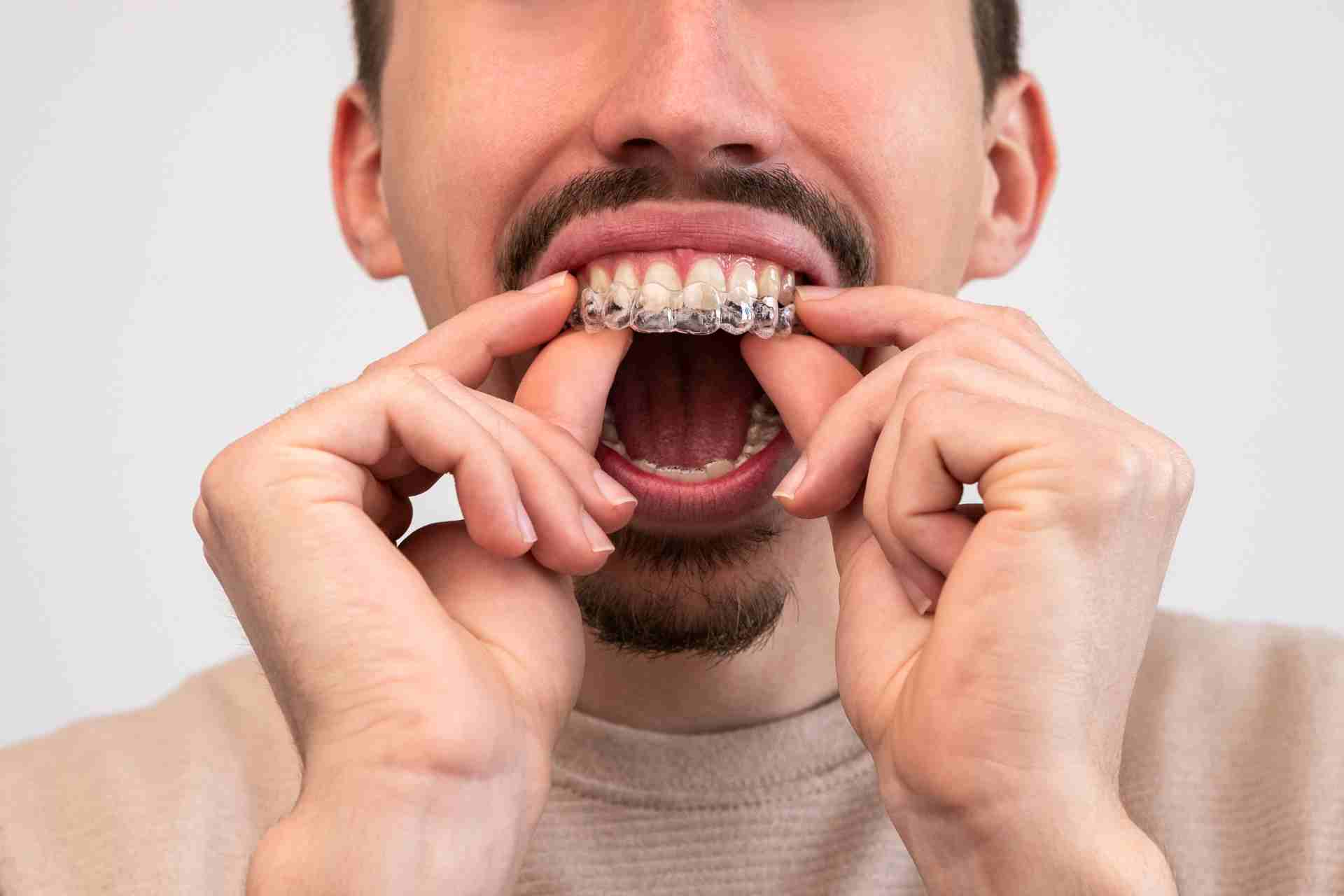 Does Invisalign Hurt?